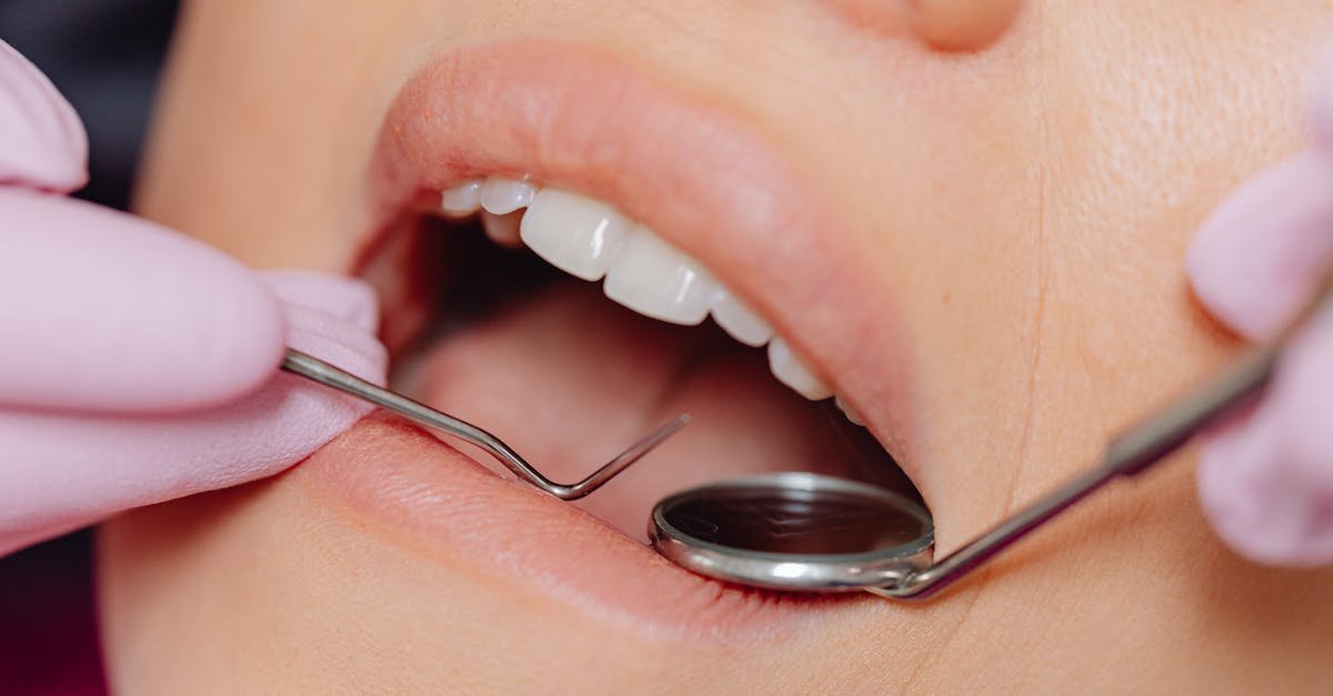 Cómo mantener una buena salud dental: consejos prácticos para una sonrisa sana
